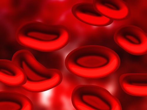 白血球が少ない原因とは？白血病になる？増やすためにはこの方法。