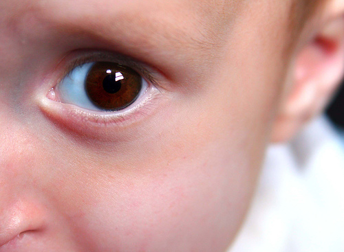 赤ちゃんの貧血は目の下のくまで症状がわかる？改善方法は？ イケてる男子のブレインミルク